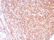 IHC staining of FFPE human tonsil tissue with CD21 antibody (clone CR2/8880R). HIER: boil tissue sections in pH 9 10mM Tris with 1mM EDTA for 20 min and allow to cool before testing.