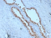 IHC staining of FFPE human prostate tissue with Prostein antibody (clone SLC45A3/7650). HIER: boil tissue sections in pH 9 10mM Tris with 1mM EDTA for 20 min and allow to cool before testing.