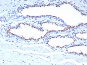 IHC staining of FFPE human prostate tissue with SLC45A3 antibody (clone SLC45A3/7653). HIER: boil tissue sections in pH 9 10mM Tris with 1mM EDTA for 20 min and allow to cool before testing.