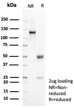 SDS-PAGE analysis of purified, BSA-free Interleukin 10 antibody (clone IL10/8711) as confirmation of integrity and purity.