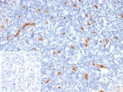 IHC staining of FFPE human tonsil tissue with CD34 antibody (clone CD34/7721). Inset: PBS used in place of primary Ab (secondary Ab negative control). HIER: boil tissue sections in pH 9 10mM Tris with 1mM EDTA for 20 min and allow to cool before testing.