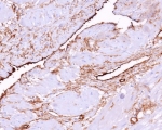 IHC staining of FFPE human uterus tissue with CD34 antibody (clone CD34/7721). HIER: boil tissue sections in pH 9 10mM Tris with 1mM EDTA for 20 min and allow to cool before testing.