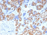 IHC staining of FFPE human placental tissue with CD34 antibody (clone CD34/7721) at 2ug/ml. Inset: PBS used in place of primary Ab (secondary Ab negative control). HIER: boil tissue sections in pH 9 10mM Tris with 1mM EDTA for 20 min and allow to cool before testing.