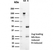 SDS-PAGE analysis of purified, BSA-free CD35 antibody (clone CR1/6379) as confirmation of integrity and purity.