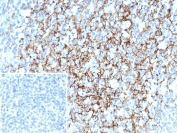IHC staining of FFPE human tonsil tissue with CD35 antibody (clone CR1/6379) at 2ug/ml. Inset: PBS used in place of primary Ab (secondary Ab negative control). HIER: boil tissue sections in pH 9 10mM Tris with 1mM EDTA for 20 min and allow to cool before testing.
