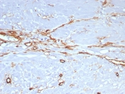 IHC staining of FFPE human uterus tissue with CD34 antibody (clone rHPCA1/8573). HIER: boil tissue sections in pH 9 10mM Tris with 1mM EDTA for 20 min and allow to cool before testing.