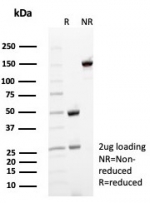 SDS-PAGE analysis of purified, BSA-free CD35 antibody (clone rCR1/8597) as confirmation of integrity and purity.