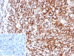 IHC staining of FFPE human tonsil tissue with CD35 antibody (clone rCR1/8597). Inset: PBS used in place of primary Ab (secondary Ab negative control). HIER: boil tissue sections in pH 9 10mM Tris with 1mM EDTA for 20 min and allow to cool before testing.