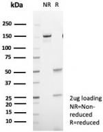 SDS-PAGE analysis of purified, BSA-free CD35 antibody (clone CR1/8244R) as confirmation of integrity and purity.