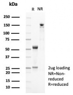 SDS-PAGE analysis of purified, BSA-free CD35 antibody (clone CR1/8282R) as confirmation of integrity and purity.