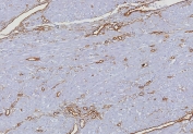 IHC staining of FFPE human uterus tissue with CD34 antibody (clone HPCA1/8333R). HIER: boil tissue sections in pH 9 10mM Tris with 1mM EDTA for 20 min and allow to cool before testing.
