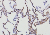 IHC staining of FFPE human lung tissue with CD34 antibody (clone HPCA1/8333R). HIER: boil tissue sections in pH 9 10mM Tris with 1mM EDTA for 20 min and allow to cool before testing.