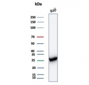 Western blot testing of human Raji cell lysate with Proliferating Cell Nuclear Antigen antibody (clone PCNA/8303R). Predicted molecular weight ~29 kDa, routinely observed at 29~36 kDa.