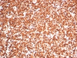 IHC staining of FFPE human tonsil tissue with PCNA antibody (clone PCNA/8303R). HIER: boil tissue sections in pH 9 10mM Tris with 1mM EDTA for 20 min and allow to cool before testing.