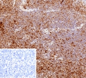 IHC staining of FFPE human tonsil tissue with PCNA antibody (clone PCNA/8633R). Inset: PBS used in place of primary Ab (secondary Ab negative control). HIER: boil tissue sections in pH 9 10mM Tris with 1mM EDTA for 20 min and allow to cool before testing.