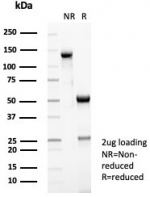 SDS-PAGE analysis of purified, BSA-free CD35 antibody (clone CR1/8283R) as confirmation of integrity and purity.