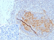 IHC staining of FFPE human tonsil tissue with CD35 antibody (clone CR1/8223R). Inset: PBS used in place of primary Ab (secondary Ab negative control). HIER: boil tissue sections in pH 9 10mM Tris with 1mM EDTA for 20 min and allow to cool before testing.