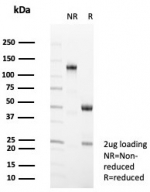 SDS-PAGE analysis of purified, BSA-free CD35 antibody (clone CR1/8598R) as confirmation of integrity and purity.