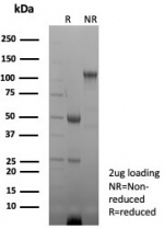 SDS-PAGE analysis of purified, BSA-free Complement receptor 1 antibody (clone CD35/8833R) as confirmation of integrity and purity.