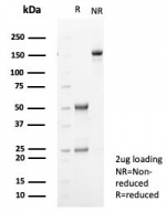 SDS-PAGE analysis of purified, BSA-free TGF beta 2 antibody (clone TGFB2/1679) as confirmation of integrity and purity.