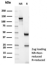 SDS-PAGE analysis of purified, BSA-free MSA antibody (clone MSA/8949R) as confirmation of integrity and purity.