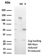 SDS-PAGE analysis of purified, BSA-free KCNJ6 antibody (clone KCNJ6/7557) as confirmation of integrity and purity.