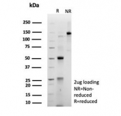 SDS-PAGE analysis of purified, BSA-free Sarcomeric Actinin Alpha 2 antibody (clone ACTN2/8184R) as confirmation of integrity and purity.