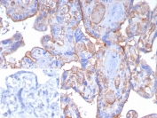 IHC staining of FFPE human placental tissue with CD141 antibody (clone THBD/8188R). Inset: PBS used in place of primary Ab (secondary Ab negative control). HIER: boil tissue sections in pH 9 10mM Tris with 1mM EDTA for 20 min and allow to cool before testing.