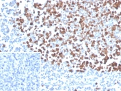 IHC staining of FFPE human tonsil tissue with PCNA antibody (clone PCNA/4540) at 2ug/ml. Inset: PBS used in place of primary Ab (secondary Ab negative control). HIER: boil tissue sections in pH 9 10mM Tris with 1mM EDTA for 20 min and allow to cool before testing.