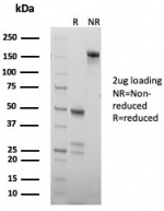 SDS-PAGE analysis of purified, BSA-free Chromogranin B antibody (clone CHGB/7756) as confirmation of integrity and purity.