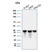 Western blot testing of human tumor cell lysates with recombinant PCNA antibody. Predicted molecular weight ~29 kDa, routinely observed at 29~36 kDa.
