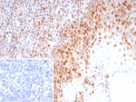 IHC staining of FFPE human tonsil tissue with recombinant PCNA antibody (clone rPCNA/8858) at 2ug/ml. Inset: PBS used in place of primary Ab (secondary Ab negative control). HIER: boil tissue sections in pH 9 10mM Tris with 1mM EDTA for 20 min and allow to cool before testing.