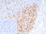 IHC staining of FFPE human tonsil tissue with PCNA antibody (clone rPCNA/8859) at 2ug/ml. Inset: PBS used in place of primary Ab (secondary Ab negative control). HIER: boil tissue sections in pH 9 10mM Tris with 1mM EDTA for 20 min and allow to cool before testing.