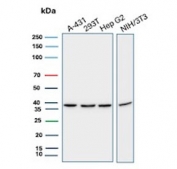 IHC staining of FFPE human tonsil tissue with PCNA antibody (clone rPCNA/8859) at 2ug/ml. Inset: PBS used in place of primary Ab (secondary Ab negative control). HIER: boil tissue sections in pH 9 10mM Tris with 1mM EDTA for 20 min and allow to cool before testing.