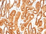 IHC staining of FFPE human kidney tissue with MIF antibody (clone MIF/6277). HIER: boil tissue sections in pH 9 10mM Tris with 1mM EDTA for 20 min and allow to cool before testing.