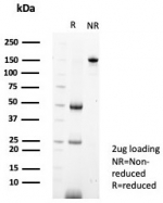 SDS-PAGE analysis of purified, BSA-free MIF antibody (clone MIF/6280) as confirmation of integrity and purity.