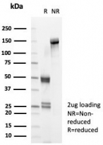 SDS-PAGE analysis of purified, BSA-free CD40 antibody (clone CD40/4940) as confirmation of integrity and purity.