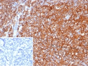 IHC staining of FFPE human tonsil tissue with CD40 antibody (clone CD40/4940). Inset: PBS used in place of primary Ab (secondary Ab negative control). HIER: boil tissue sections in pH 9 10mM Tris with 1mM EDTA for 20 min and allow to cool before testing.