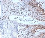 IHC staining of FFPE human skin tissue with SOX18 antibody (clone SOX18/3271). Inset: PBS used in place of primary Ab (secondary Ab negative control). HIER: boil tissue sections in pH 9 10mM Tris with 1mM EDTA for 20 min and allow to cool before testing.