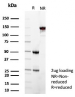 SDS-PAGE analysis of purified, BSA-free SOD1 antibody (clone SOD1/4593) as confirmation of integrity and purity.