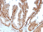 IHC staining of FFPE human prostate tissue with SOD1 antibody (clone SOD1/4593). HIER: boil tissue sections in pH 9 10mM Tris with 1mM EDTA for 20 min and allow to cool before testing.