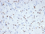 IHC staining of FFPE human brain tissue (RNA expression: 54.2 nTPM) with OLIG2 antibody (clone OLIG2/7366R). HIER: boil tissue sections in pH 9 10mM Tris with 1mM EDTA for 20 min and allow to cool before testing.