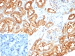 IHC staining of FFPE human kidney tissue with MIF antibody (clone MIF/6279). Inset: PBS used in place of primary Ab (secondary Ab negative control). HIER: boil tissue sections in pH 9 10mM Tris with 1mM EDTA for 20 min and allow to cool before testing.