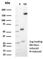 SDS-PAGE analysis of purified, BSA-free MIF antibody (clone MIF/6279) as confirmation of integrity and purity.
