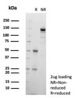 SDS-PAGE analysis of purified, BSA-free GIRK2 antibody (clone KCNJ6/7559) as confirmation of integrity and purity.