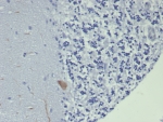IHC staining of FFPE human brain tissue with GIRK2 antibody (clone KCNJ6/7559) at 2ug/ml. HIER: boil tissue sections in pH 9 10mM Tris with 1mM EDTA for 20 min and allow to cool before testing.