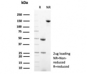 SDS-PAGE analysis of purified, BSA-free Myxovirus resistance protein 1 antibody (clone MX1/7530) as confirmation of integrity and purity.