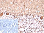IHC staining of FFPE human brain tissue with S100B antibody (clone S100B/4148). Inset: PBS used in place of primary Ab (secondary Ab negative control). HIER: boil tissue sections in pH 9 10mM Tris with 1mM EDTA for 20 min and allow to cool before testing.