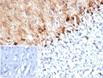 IHC staining of FFPE human brain tissue with S100B antibody (clone S100B/4152) at 2ug/ml. Inset: PBS used in place of primary Ab (secondary Ab negative control). HIER: boil tissue sections in pH 9 10mM Tris with 1mM EDTA for 20 min and allow to cool before testing.