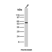 PRAME Antibody K562 WB. Western blot analysis of human K562 cell lysate using PRAME antibody clone PRAME/8558R. A distinct band is detected at approximately 58-60 kDa, consistent with the expected molecular weight of Preferentially expressed antigen in melanoma / PRAME, a cancer-testis antigen involved in transcriptional regulation and tumor-associated immune signaling pathways. The observed signal is consistent with established PRAME expression in hematologic tumor-derived cell models.